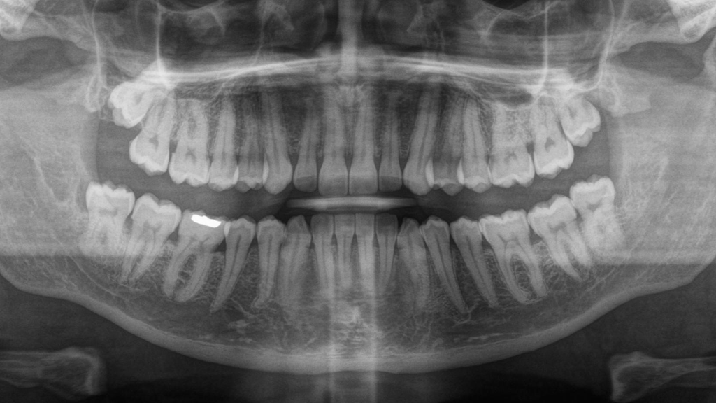 centro-radiografias-vina-del-mar
