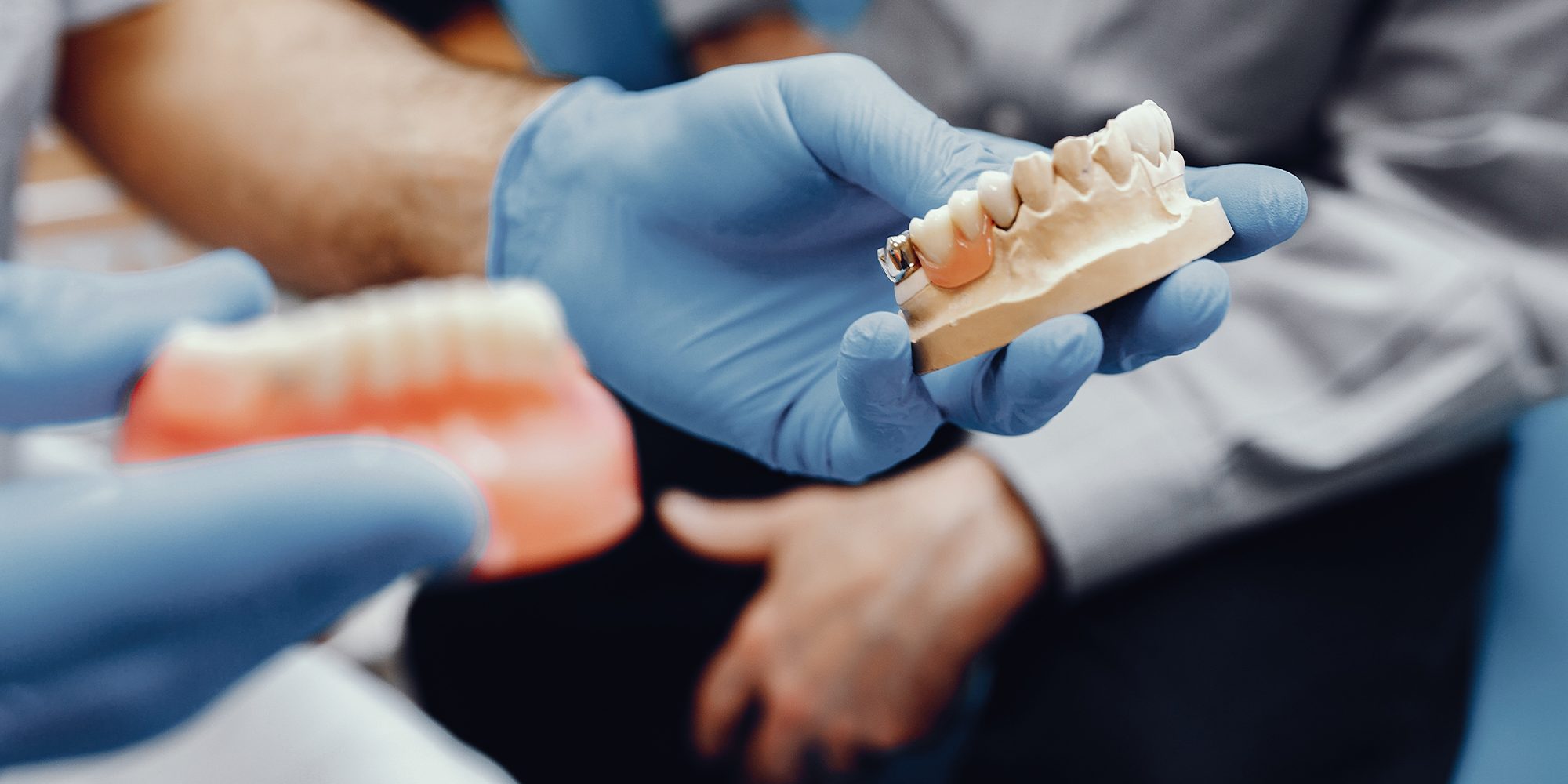 Close up Process Implants teeth health care on white background.
