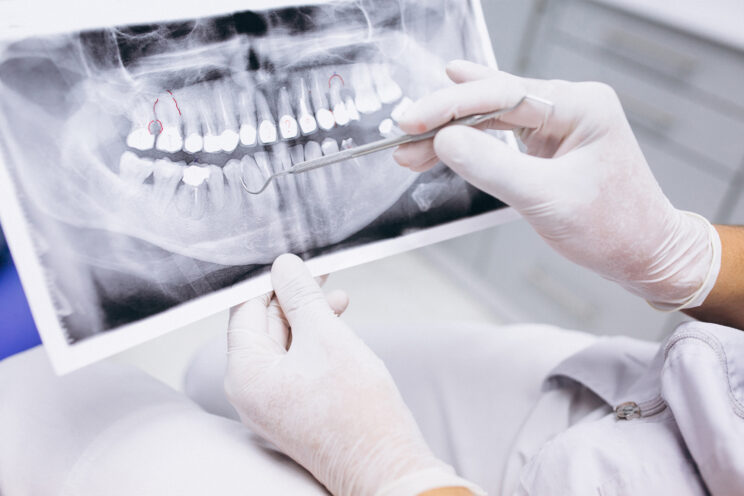 Close up Process Implants teeth health care on white background.
