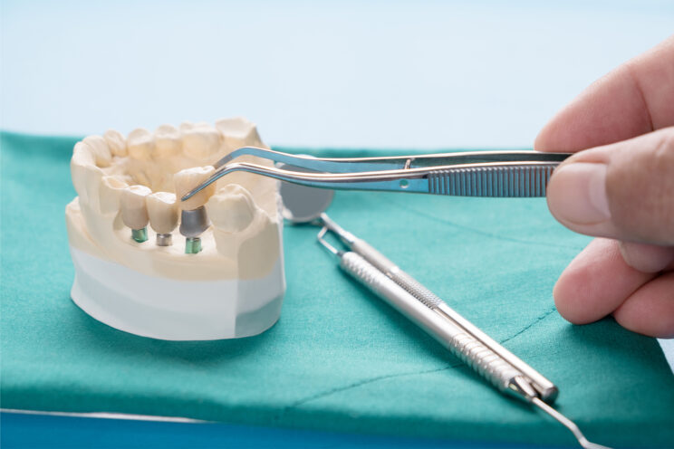 Close up Process Implants teeth health care on white background.