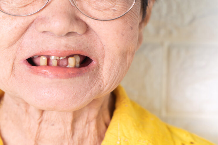 Close up Process Implants teeth health care on white background.