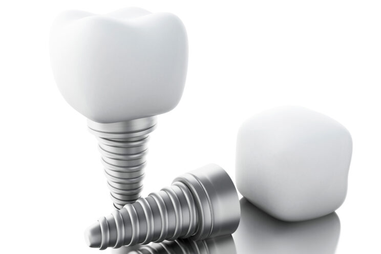 Close up Process Implants teeth health care on white background.