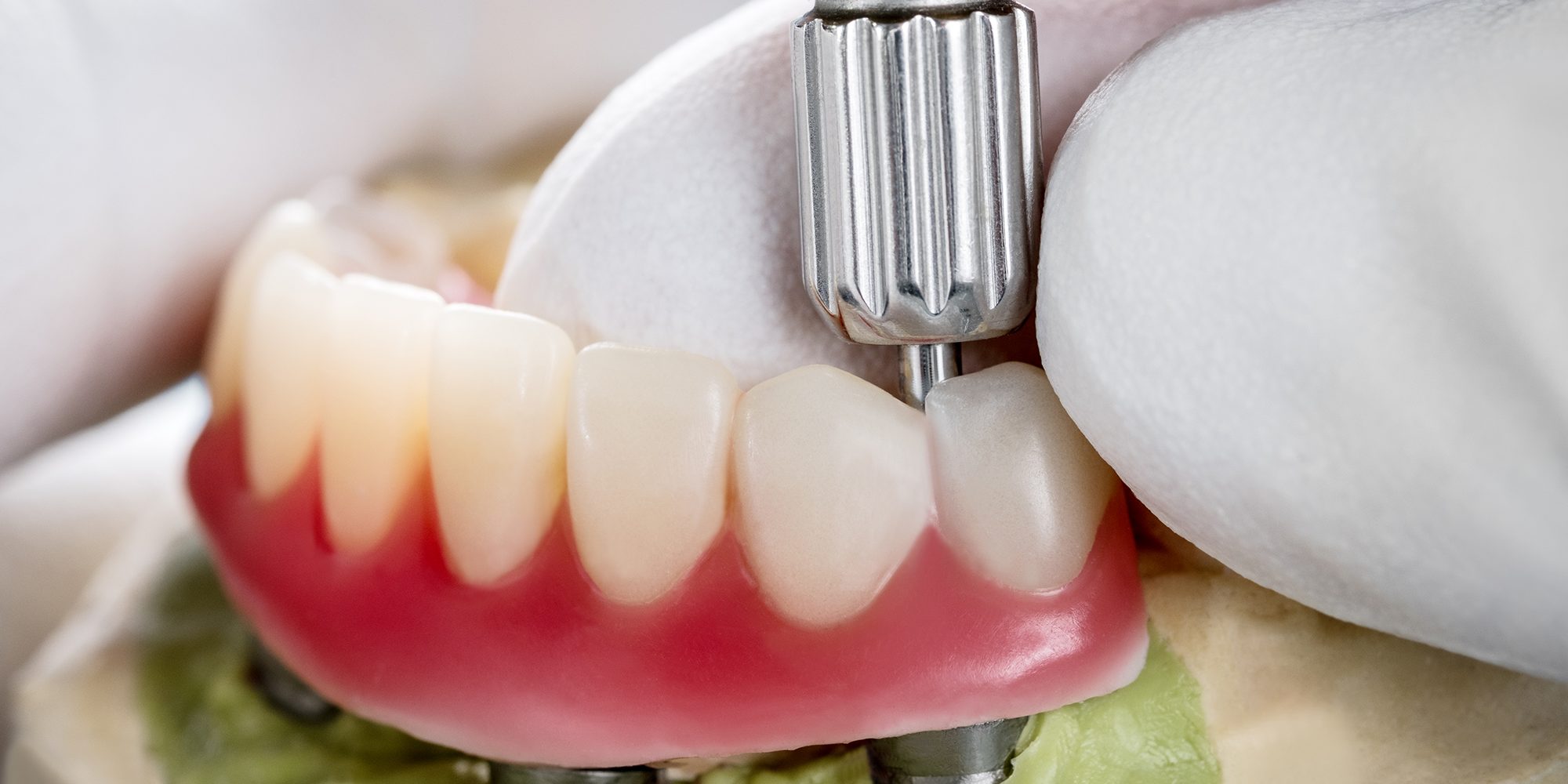 Close up Process Implants teeth health care on white background.