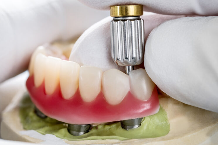 Close up Process Implants teeth health care on white background.