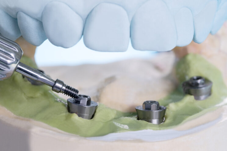 Close up Process Implants teeth health care on white background.