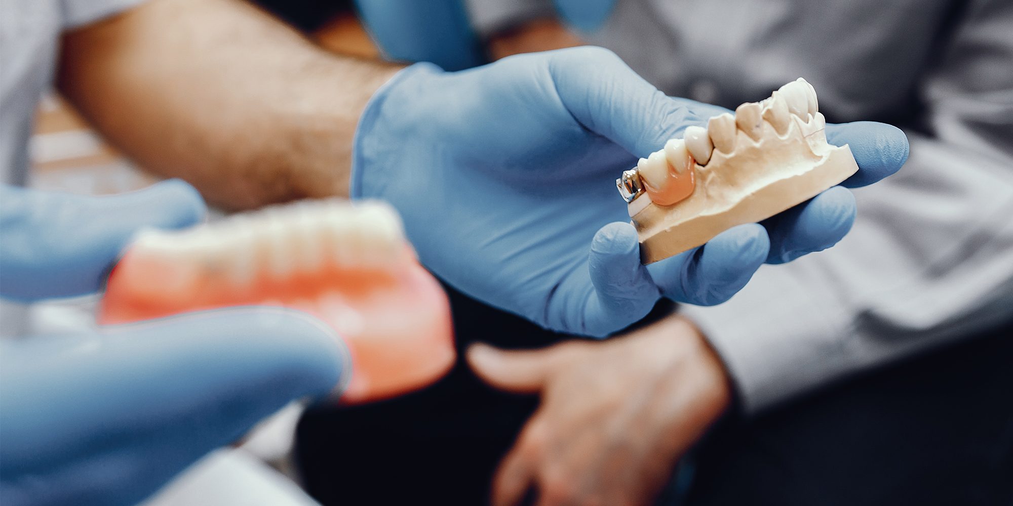 Close up Process Implants teeth health care on white background.