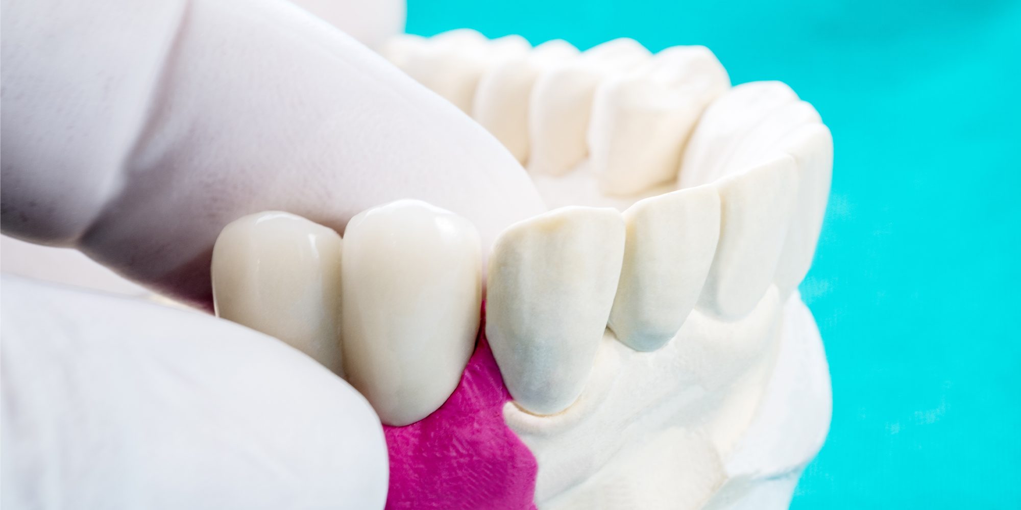 Close up Process Implants teeth health care on white background.