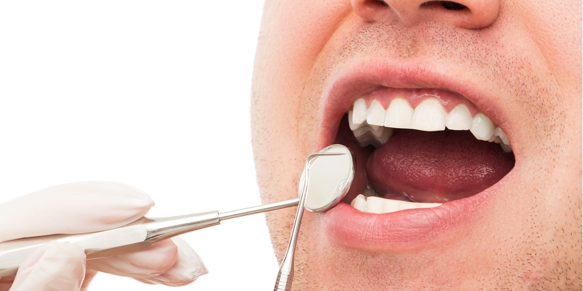 Close up Process Implants teeth health care on white background.