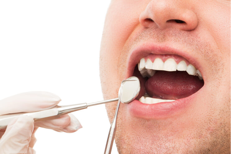 Close up Process Implants teeth health care on white background.