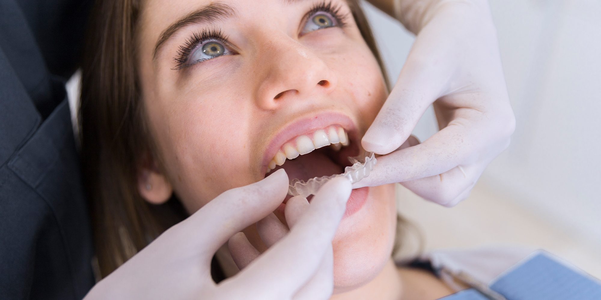 Close up Process Implants teeth health care on white background.