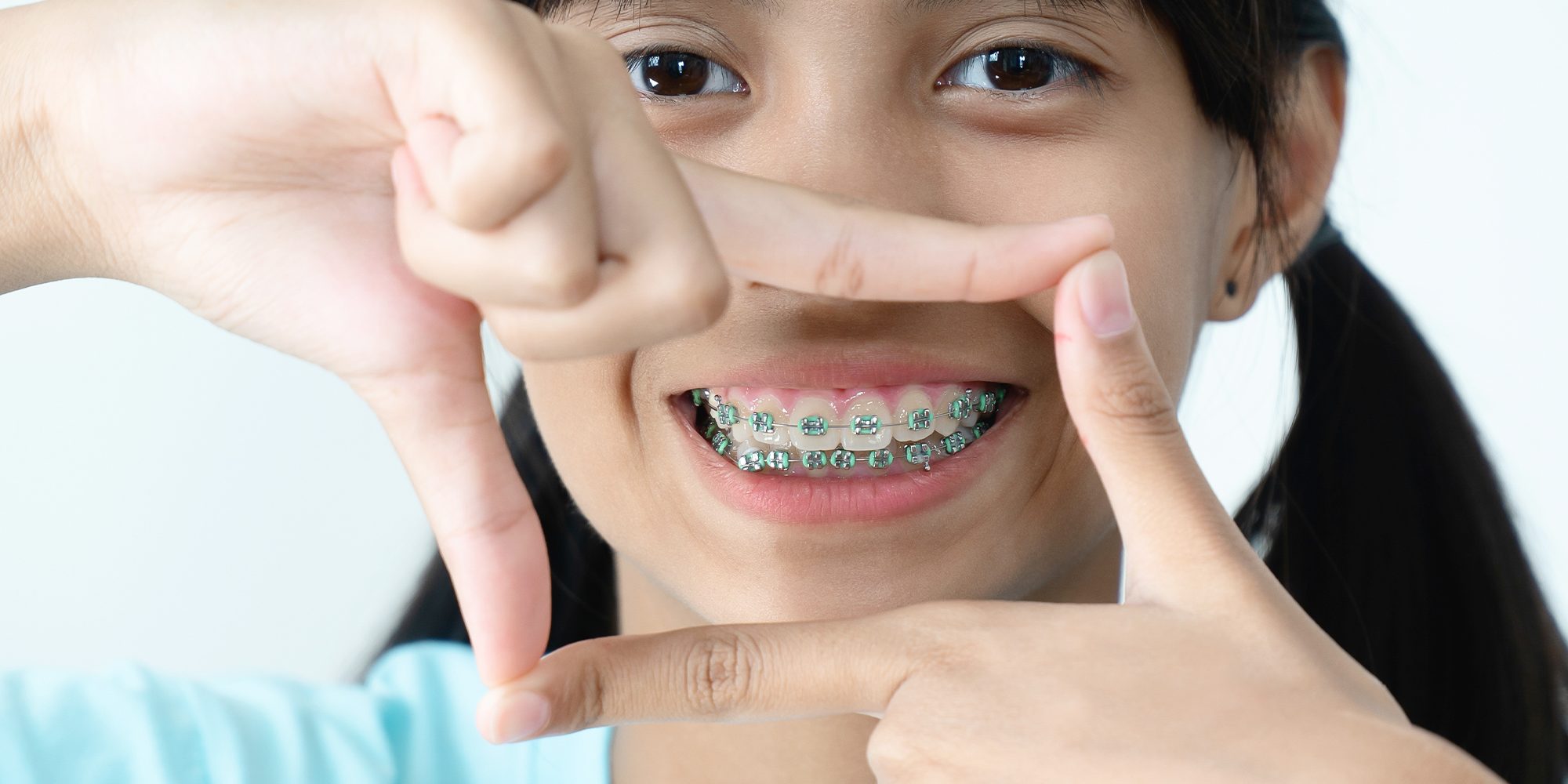 Close up Process Implants teeth health care on white background.