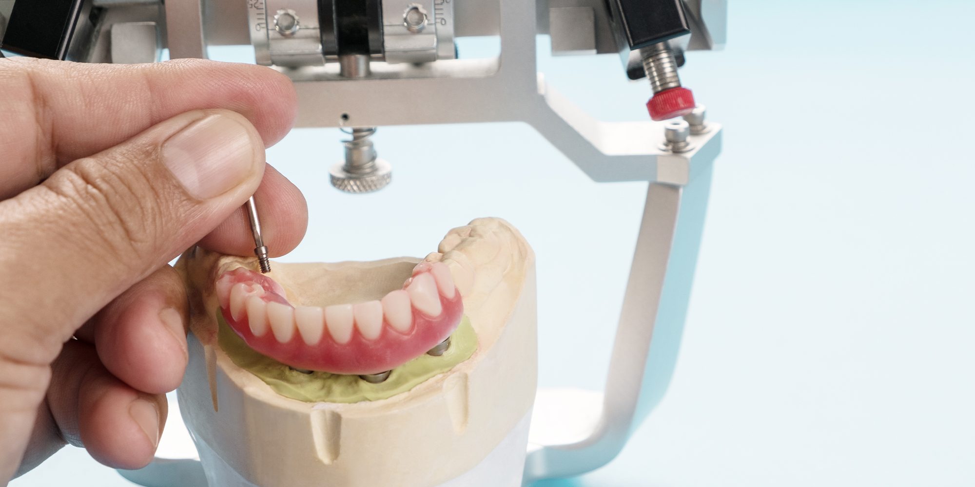 Close up Process Implants teeth health care on white background.