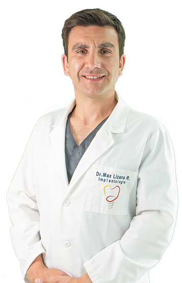 implantologo-dental-doctor-max-lizana