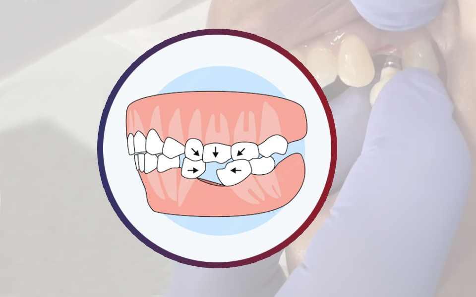 recupera-tus-dientes