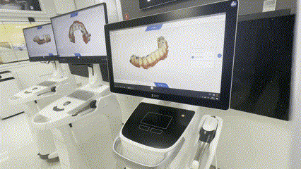 Escaneamos tu implantes dentales