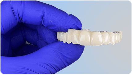Cirugía de implante dental segura